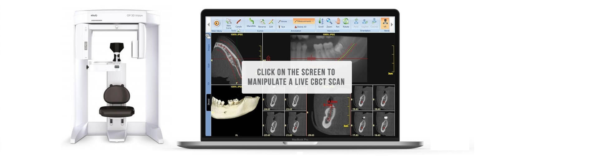 CT Dent cbst-scan-demo slider 3  